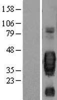 SCF (KITLG) Human Over-expression Lysates NM_000899