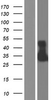 SCF (KITLG) Human Over-expression Lysates NM_003994
