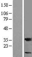 MGST3 Human Over-expression Lysates NM_004528