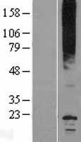 Aquaporin 0 (MIP) Human Over-expression Lysates NM_012064