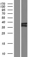 ls004287 ataxin 3 atxn3 human over expression lysates nm 030660 wb testing 2