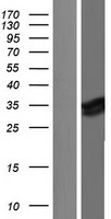 Myeloid leukemia factor 1 (MLF1) Human Over-expression Lysates NM_001195432