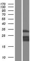 Myeloid leukemia factor 1 (MLF1) Human Over-expression Lysates NM_001195433