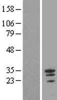Myeloid leukemia factor 1 (MLF1) Human Over-expression Lysates NM_022443