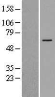 FOXO4 Human Over-expression Lysates NM_005938
