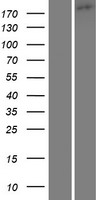 TRPM1 Human Over-expression Lysates NM_002420
