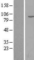 CD10 (MME) Human Over-expression Lysates NM_007287