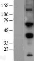 MMP14 Human Over-expression Lysates NM_004995