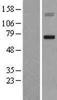 MMP15 Human Over-expression Lysates NM_002428