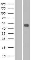 MMP16 Human Over-expression Lysates NM_022564