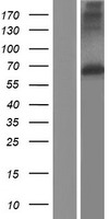 MMP17 Human Over-expression Lysates NM_016155