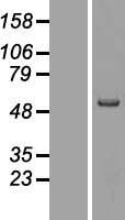 MMP19 Human Over-expression Lysates NM_002429