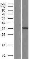 ls004331 mnat1 human over expression lysates nm 001177963 wb testing 1