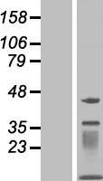 MOCS2 Human Over-expression Lysates NM_176806