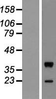 MOS Human Over-expression Lysates NM_005372