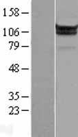 MOV10 Human Over-expression Lysates NM_001130079