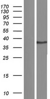 CD200 Human Over-expression Lysates NM_001004196