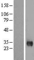 MPG Human Over-expression Lysates NM_001015054