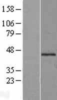 Mannose Phosphate Isomerase (MPI) Human Over-expression Lysates NM_002435