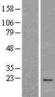 ls004358 mpv17 human over expression lysates nm 002437 wb testing 1