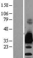 Myelin Protein Zero (MPZ) Human Over-expression Lysates NM_000530