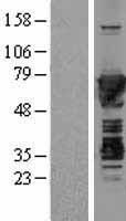 Moesin (MSN) Human Over-expression Lysates NM_002444