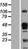 Macrophage Scavenger Receptor I (MSR1) Human Over-expression Lysates NM_138716