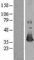 ls004482 methionine sulfoxide reductase a msra human over expression lysates nm 012331 wb testing 1