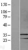 MSX1 Human Over-expression Lysates NM_002448