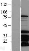 MSX2 Human Over-expression Lysates NM_002449