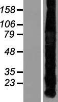 ls004489 metallothionein mt1a human over expression lysates nm 005946 wb testing 1