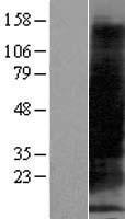 MT1B Human Over-expression Lysates NM_005947