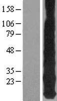 ls004493 mt1e human over expression lysates nm 175617 wb testing 1