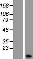 MT1F Human Over-expression Lysates NM_005949