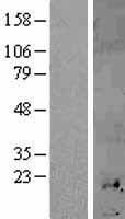MT1H Human Over-expression Lysates NM_005951