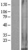 MT1M Human Over-expression Lysates NM_176870