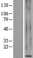 ls004501 mt1x human over expression lysates nm 005952 wb testing 1