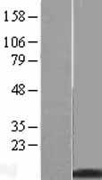 Metallothionein (MT2A) Human Over-expression Lysates NM_005953
