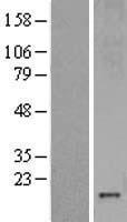 MT3 Human Over-expression Lysates NM_005954