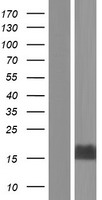 MTCP1 Human Over-expression Lysates NM_001018025