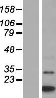 MTCP1 Human Over-expression Lysates NM_014221