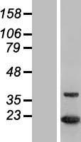 MTH1 (NUDT1) Human Over-expression Lysates NM_198949