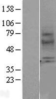 Melatonin Receptor 1A (MTNR1A) Human Over-expression Lysates NM_005958