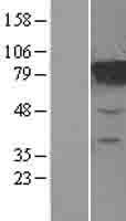 MTRR Human Over-expression Lysates NM_024010