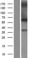 MYH (MUTYH) Human Over-expression Lysates NM_001048172