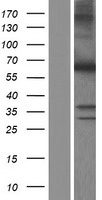 MYH (MUTYH) Human Over-expression Lysates NM_001128425