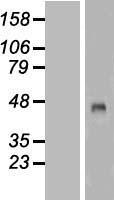 MVD Human Over-expression Lysates NM_002461