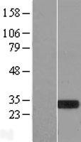 MXI1 Human Over-expression Lysates NM_001008541