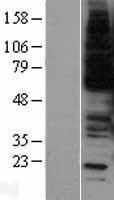 c-Myb (MYB) Human Over-expression Lysates NM_005375