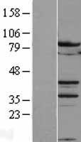 B MyB (MYBL2) Human Over-expression Lysates NM_002466
